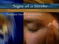 Stroke Signs and Symptoms