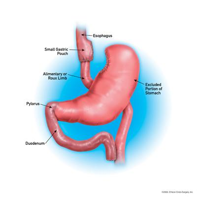 stomach diagram